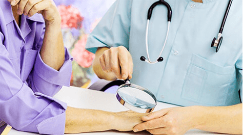 Papilomaren diagnostikoa eta tratamendua