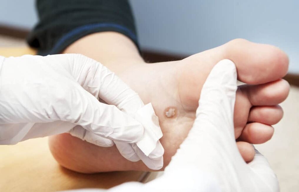 zergatik agertzen dira garatxoak gorputzean